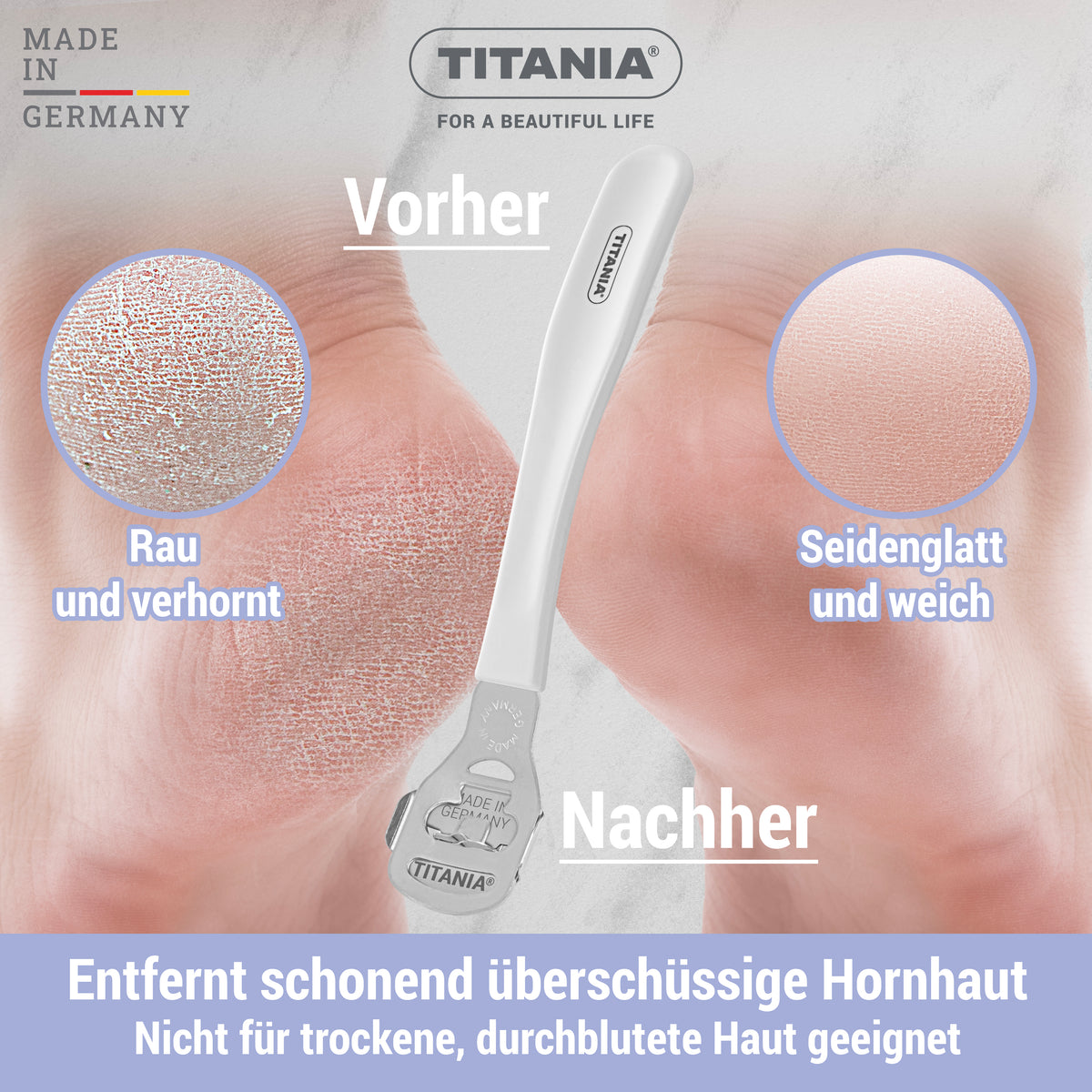 Rostfreier Hornhauthobel (15 cm)