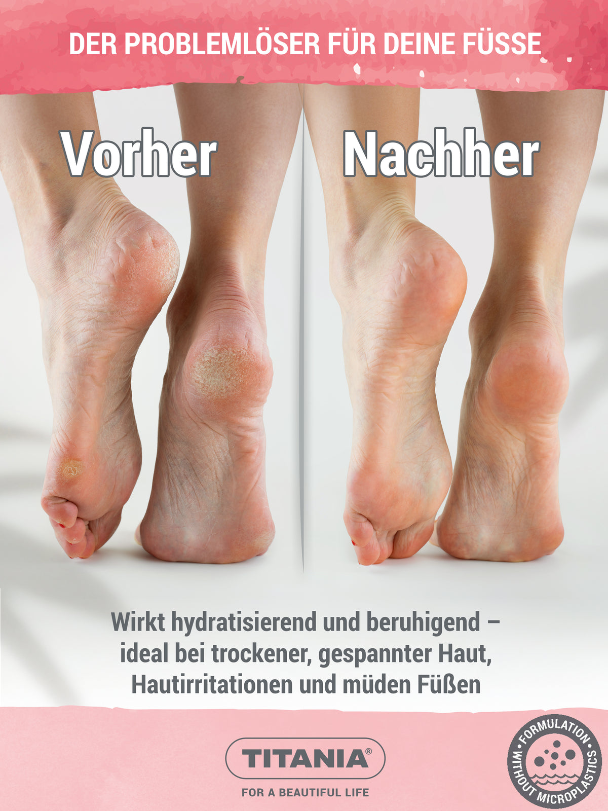 Fußcreme für sehr trockene Füße mit Urea 10%