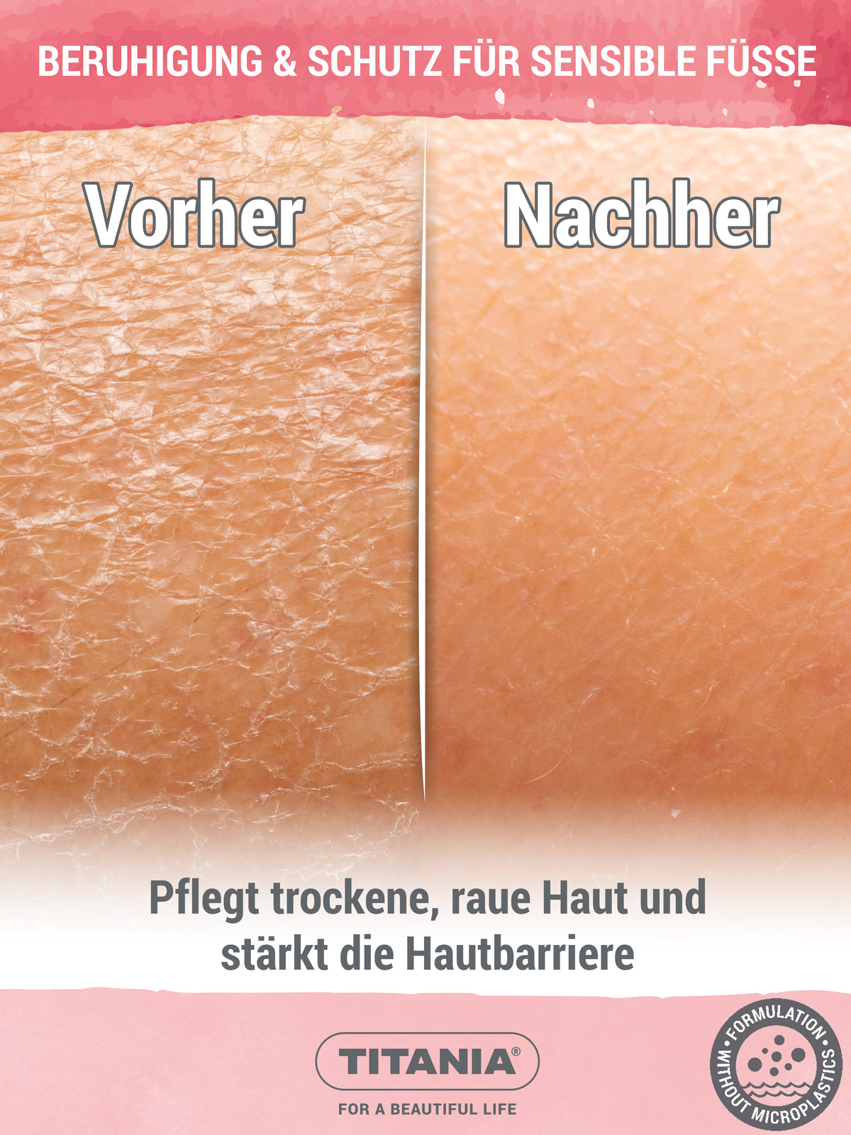 Sensitiv Fußcreme für empfindliche Haut, parfümfrei