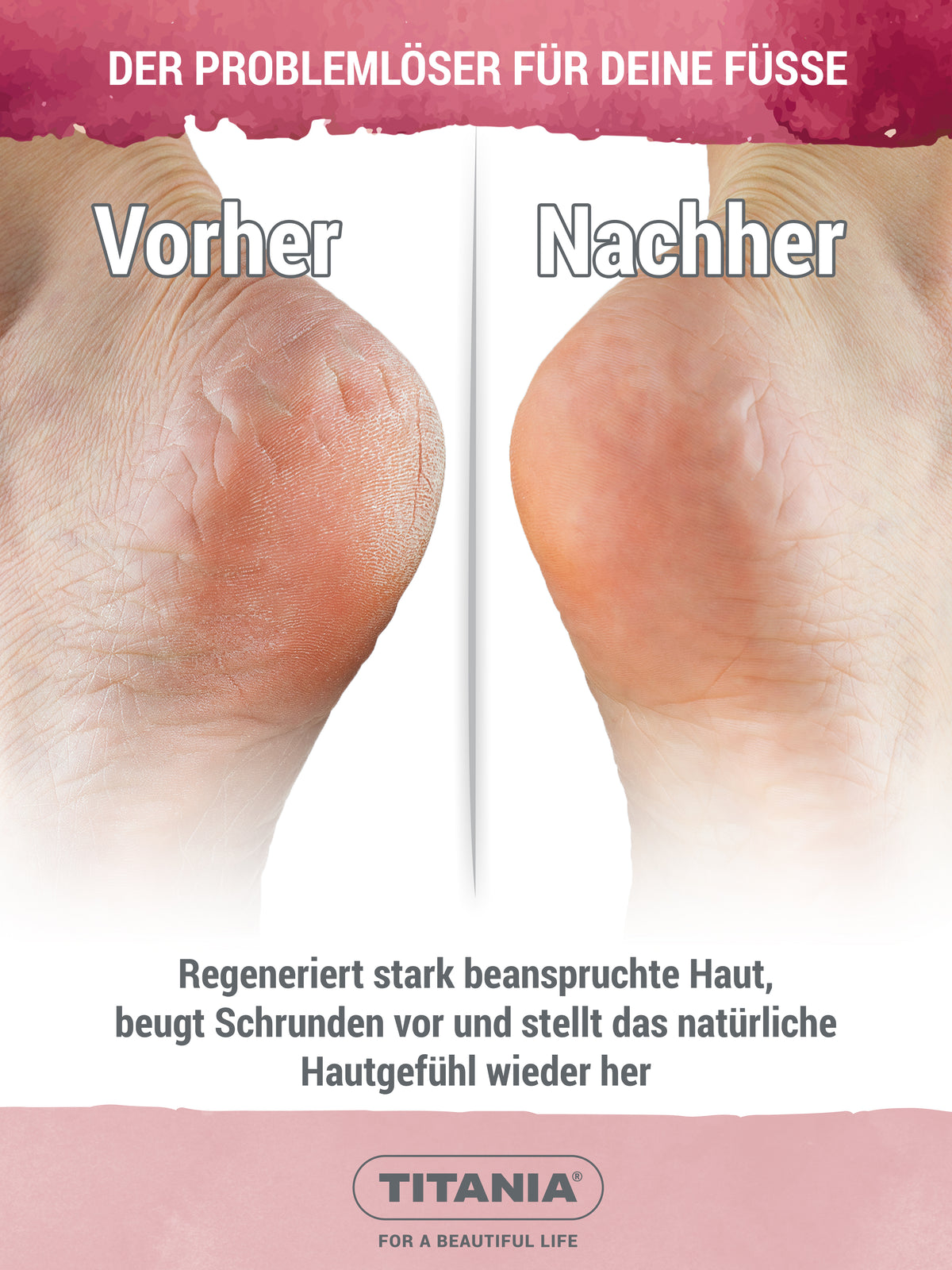 Schrunden Salbe für rissige & trockene Füße